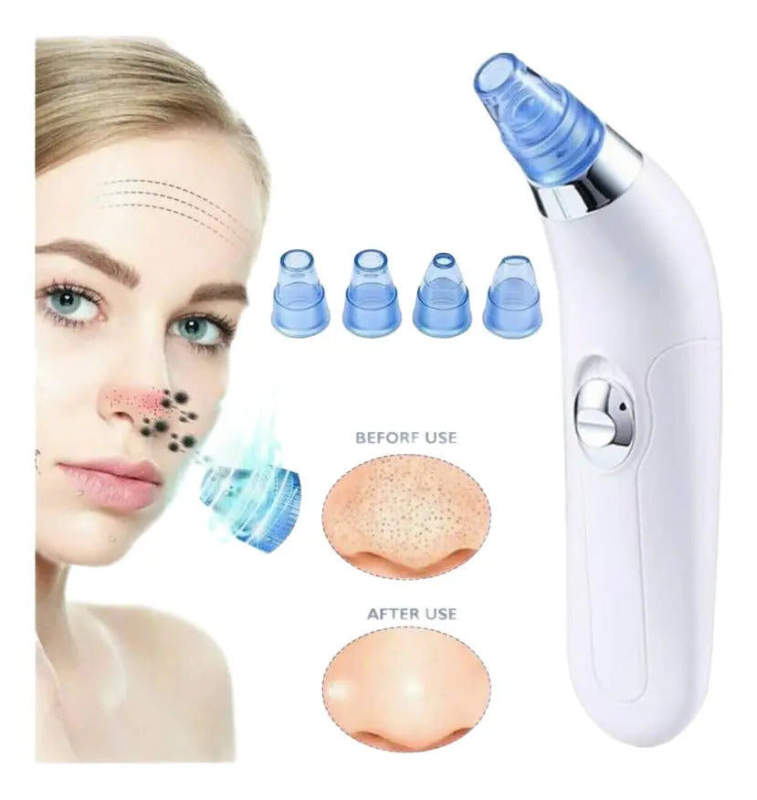 Removedor Extractor De Puntos Negros Limpieza Facial - vista 4